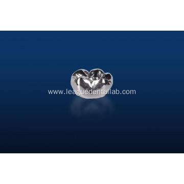 Full Cast High Noble Metal Crown